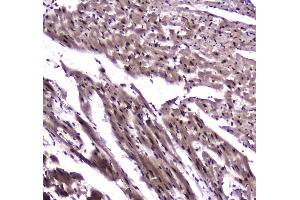 IHC analysis of NFIB/NF1B2 using anti-NFIB/NF1B2 antibody .