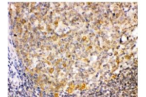 IHC analysis of TRIB2 using anti-TRIB2 antibody (ABIN3044555). (TRIB2 anticorps  (Middle Region))
