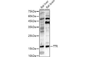 Western blot analysis of extracts of various cell lines, using TTR antibody (ABIN3021473, ABIN3021474, ABIN3021475 and ABIN6215107) at 1:500 dilution. (TTR anticorps  (AA 21-147))