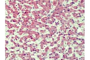 Human Liver: Formalin-Fixed, Paraffin-Embedded (FFPE) (IRAK4 anticorps  (N-Term))