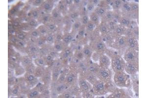 DAB staining on IHC-P; Samples: Mouse Liver Tissue