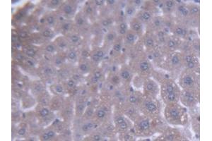 DAB staining on IHC-P; Samples: Mouse Liver Tissue (ACAA1 anticorps  (AA 182-424))