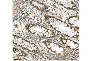 IHC analysis of Aconitase 1/ACO1 using anti-Aconitase 1/ACO1 antibody (ABIN7598988). (Aconitase 1 anticorps  (AA 1-137))