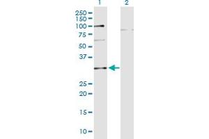 Western Blot analysis of C10orf63 expression in transfected 293T cell line by C10orf63 monoclonal antibody (M05), clone 3E8. (ENKUR anticorps  (AA 1-256))