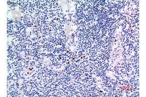 Immunohistochemistry (IHC) analysis of paraffin-embedded Human Lymph Gland, antibody was diluted at 1:100. (IDH3A anticorps  (Internal Region))