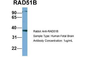 Host: Rabbit  Target Name: RAD51B  Sample Tissue: Human Fetal Brain  Antibody Dilution: 1. (RAD51 Homolog B anticorps  (Middle Region))