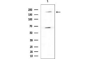 Western blot analysis of lysates from Rat brain, using WNK3 Antibody at 1/1000 dilution.