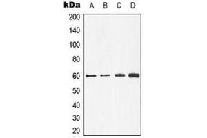 Western blot analysis of CDC25C expression in A431 (A), MCF7 (B), mouse kidney (C), rat heart (D) whole cell lysates. (CDC25C anticorps  (Center))