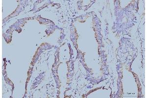 IHC analysis of EIF4A1 using anti-EIF4A1 antibody (ABIN7603144). (EIF4A1 anticorps  (N-Term))
