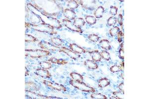 Immunohistochemistry of paraffin-embedded mouse kidney using LONP1 Rabbit pAb (ABIN1680707, ABIN3018785, ABIN3018786 and ABIN6220576) at dilution of 1:100 (40x lens). (LONP1 anticorps  (AA 120-400))