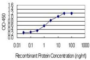 anti-Zinc Finger and BTB Domain Containing 7B (ZBTB7B) (AA 433-537) antibody