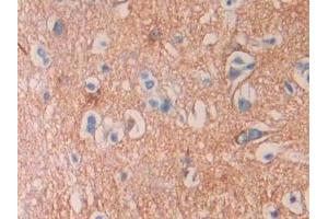 Detection of SEPT5 in Human Cerebrum Tissue using Polyclonal Antibody to Septin 5 (SEPT5)