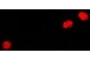 Immunofluorescent analysis of GADD45 alpha staining in A549 cells.