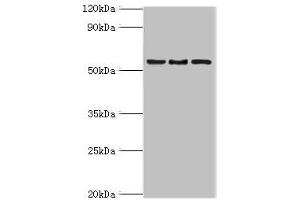 Western blot All lanes: ARFGAP3 antibody at 4 μg/mL Lane 1: HepG2 whole cell lysate Lane 2: Jurkat whole cell lysate Lane 3: A549 whole cell lysate Secondary Goat polyclonal to rabbit IgG at 1/10000 dilution Predicted band size: 57, 52 kDa Observed band size: 57 kDa (ARFGAP3 anticorps  (AA 217-516))