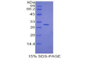 SDS-PAGE analysis of Human IkBd Protein. (IkBd Protéine)