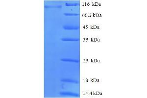 SDS-PAGE (SDS) image for Peptidyl Arginine Deiminase, Type II (PADI2) (AA 1-665), (full length) protein (His-SUMO Tag) (ABIN5711981) (PADI2 Protein (AA 1-665, full length) (His-SUMO Tag))