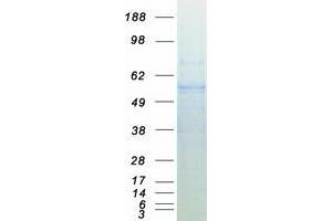 Validation with Western Blot