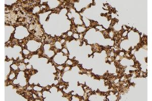 ABIN6277609 at 1/100 staining Mouse lung tissue by IHC-P. (RFC4 anticorps)
