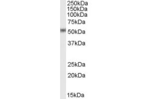 Image no. 1 for anti-STEAP Family Member 4 (STEAP4) (C-Term) antibody (ABIN375107) (STEAP4 anticorps  (C-Term))
