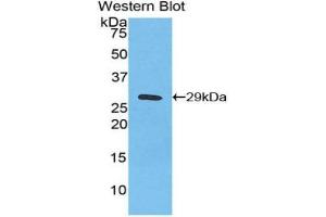 Detection of Recombinant IkBz, Human using Polyclonal Antibody to Inhibitory Subunit Of NF Kappa B Zeta (IkBz) (Inhibitory Subunit of NF-KappaB zeta (AA 422-651) anticorps)