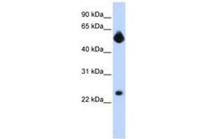 Image no. 1 for anti-Notch 4 (NOTCH4) (Internal Region) antibody (ABIN6742248) (NOTCH4 anticorps  (Internal Region))