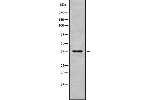 Western blot analysis of Peropsin using HeLa whole cell lysates (Peropsin anticorps  (Internal Region))