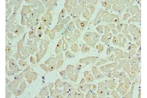 Immunohistochemistry of paraffin-embedded human heart tissue using ABIN7145306 at dilution of 1:100 (BCL2L13 anticorps  (AA 1-300))