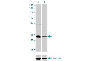 Western blot analysis of NFYB over-expressed 293 cell line, cotransfected with NFYB Validated Chimera RNAi (Lane 2) or non-transfected control (Lane 1). (NFYB anticorps  (AA 1-207))