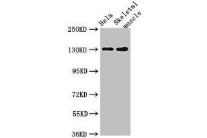 Western Blot Positive WB detected in: Hela whole cell lysate, Mouse skeletal muscle tissue All lanes: PER3 antibody at 4 μg/mL Secondary Goat polyclonal to rabbit IgG at 1/50000 dilution Predicted band size: 132, 133 kDa Observed band size: 132 kDa (PER3 anticorps  (AA 1-131))