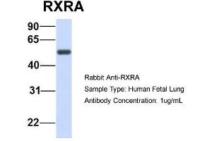 Host:  Rabbit  Target Name:  RXRA  Sample Type:  Human Fetal Lung  Antibody Dilution:  1. (Retinoid X Receptor alpha anticorps  (N-Term))