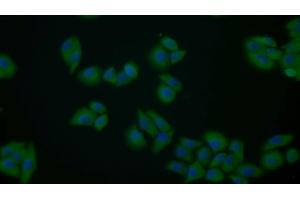 Detection of PKM2 in Human MCF7 cell using Polyclonal Antibody to Pyruvate kinase isozymes M2 (PKM2)