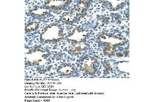Rabbit Anti-ALPP Antibody  Paraffin Embedded Tissue: Human Lung Cellular Data: Alveolar cells Antibody Concentration: 4.