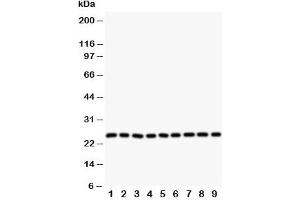 Western blot testing of SOD2 antibody and Lane 1:  rat liver;  2: (r) intestine;  3: (r) lung;  4: (r) heart;  5: human SMMC-7721;  6: (h) HeLa;  7: (h) COLO320;  8: (h) SW620;  9: (h) A549 cell lysate. (SOD2 anticorps  (N-Term))