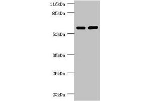 Western blot All lanes: PPP2R5C antibody at 1.