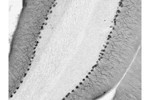Cerebellum immunohistochemistry. (DLG2 anticorps  (AA 1-852))