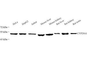 Western blot analysis of CYP20A1 (ABIN7073675) at dilution of 1: 250