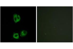 Immunofluorescence analysis of HeLa cells, using Lck (Phospho-Tyr393) Antibody. (LCK anticorps  (pTyr394))
