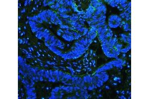 IF analysis of Integrin beta 4/ITGB4 using anti-Integrin beta 4/ITGB4 antibody (ABIN7601135). (Integrin beta 4 anticorps  (AA 29-431))