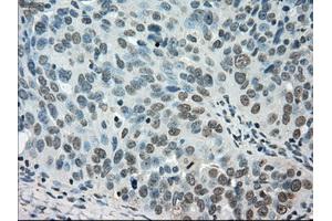 Immunohistochemical staining of paraffin-embedded Ovary tissue using anti-STK39mouse monoclonal antibody. (STK39 anticorps)