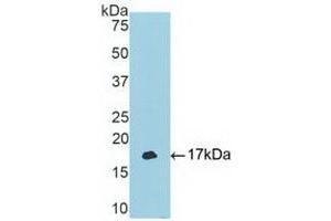 Detection of Recombinant TBX3, Human using Polyclonal Antibody to T-Box Protein 3 (TBX3) (TBX3 anticorps  (AA 107-220))