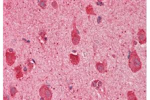 Rabbit Anti-SLC17A5 antibody  Formalin Fixed Paraffin Embedded Tissue: Human Brain, Cortex Primary antibody Concentration: 1:100 Secondary Antibody: Donkey anti-Rabbit-Cy3 Secondary Antibody Concentration: 1:200 Magnification: 20x Exposure Time: 0.