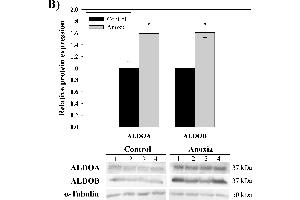 Aldolase purification and expression from the liver of control and anoxic turtles.