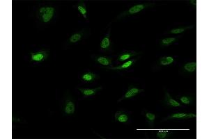 Immunofluorescence of purified MaxPab antibody to PHC1 on HeLa cell.