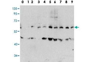 Western blot analysis of MYC (phospho T58) polyclonal antibody  in human TPA activated HeLa cell line lysates. (c-MYC anticorps  (pThr58))