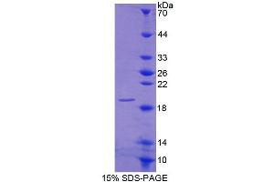 SDS-PAGE (SDS) image for Cannabinoid Receptor Interacting Protein 1 (Cnrip1) (AA 34-164) protein (His tag) (ABIN4990157)