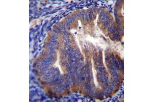 Immunohistochemistry analysis in formalin fixed and paraffin embedded human uterus tissue reacted with KLC2 Antibody (N-term) followed which was  peroxidase conjugated to the secondary antibody and followed by DAB staining. (KLC2 anticorps  (N-Term))