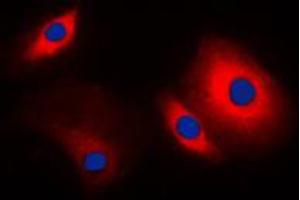 Immunofluorescent analysis of Cortactin staining in MCF7 cells.