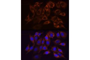 Immunofluorescence analysis of NIH/3T3 cells using NDUFS1 Rabbit pAb (ABIN7268819) at dilution of 1:50 (40x lens). (NDUFS1 anticorps  (AA 80-290))