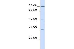 WB Suggested Anti-ERCC2 Antibody Titration:  0. (ERCC2 anticorps  (N-Term))
