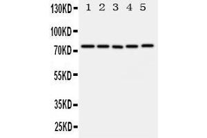 Western Blotting (WB) image for anti-ATP-Binding Cassette, Sub-Family G (WHITE), Member 1 (ABCG1) (AA 627-647), (C-Term) antibody (ABIN3044094)